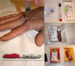 Steri kit minska risken för smitta vid eventuell sjukhusvistelse